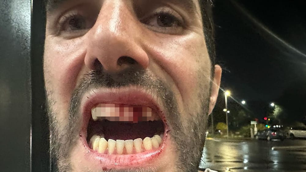 Резервиста ЦАХАЛа избили в Новой Зеландии за службу в армии Израиля — нападавший получил тюремный срок