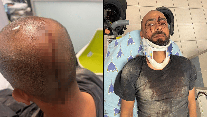 В Тель-Авиве совершено нападение на арабского рабочего — полиция не отреагировала