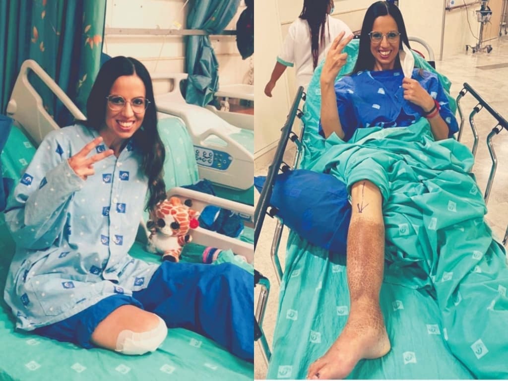 ליאורה קקון לפני הניתוח (מימין) ואחריו