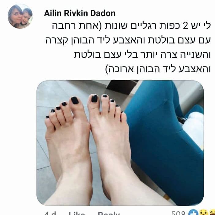 איילין דדון רגליים מתוך הפייסבוק