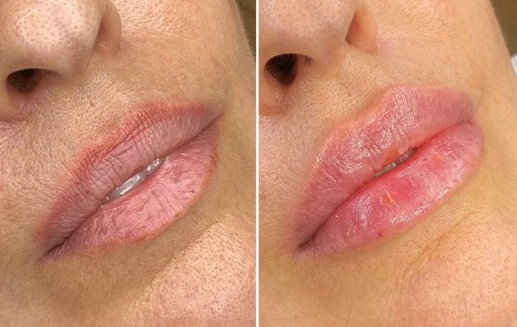 מימין: אחרי. משמאל: לפני (צילום: ד"ר לידור שמואלי) מימין: אחרי. משמאל: לפני