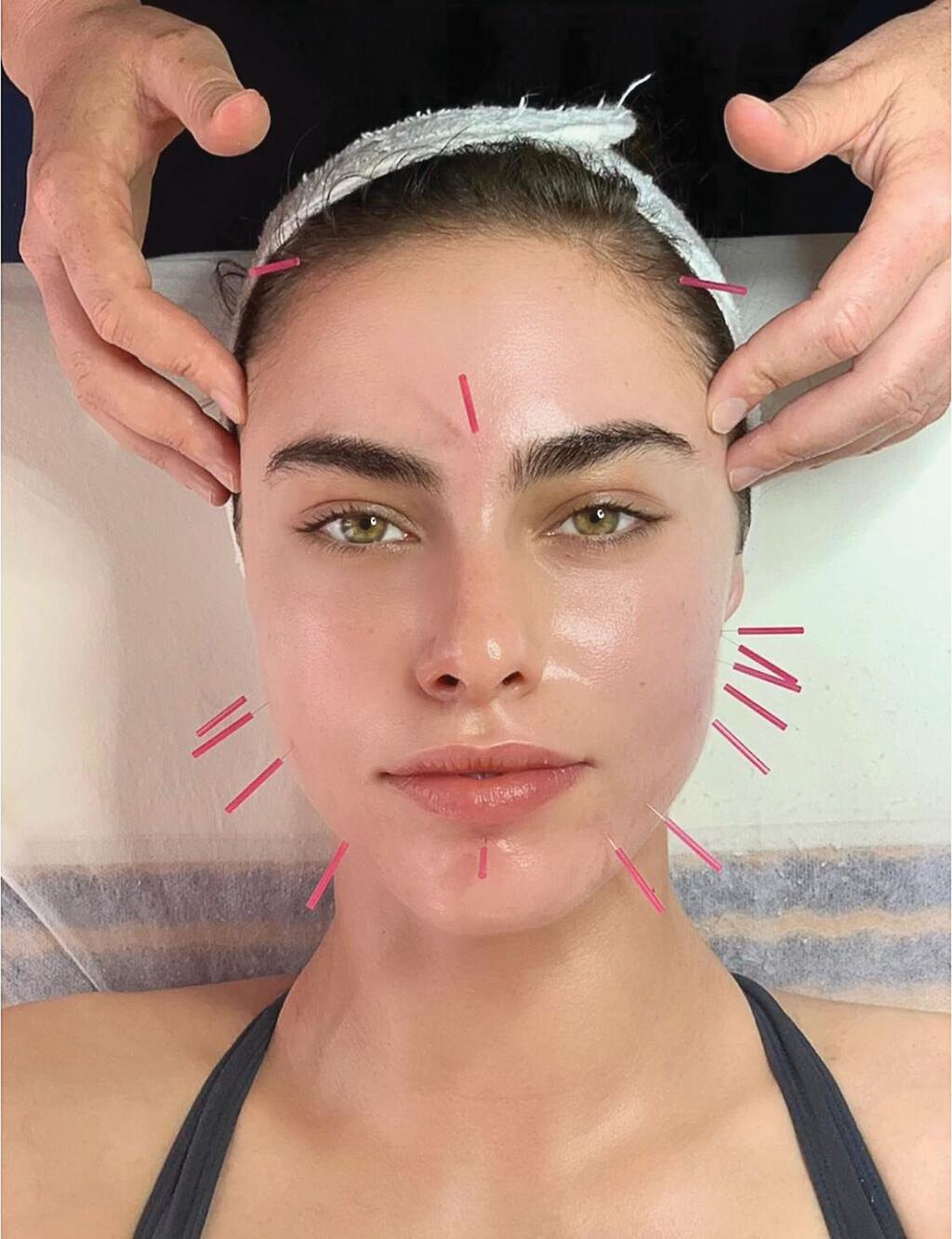 אריאל אור בקליניקה של עופרי בס