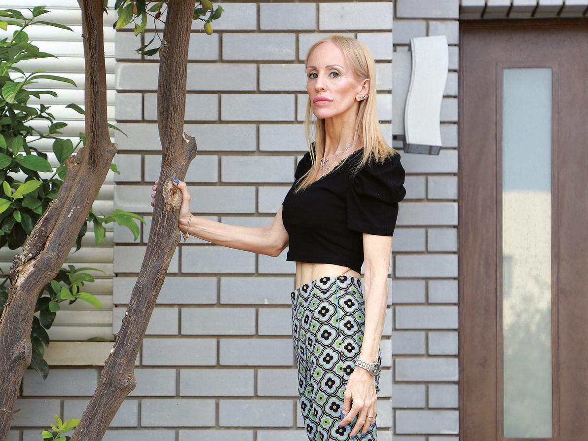 איריס כליף. " אף אחד לא האמין שאני אצא מזה" (צילום: דנה קופל) איריס כליף