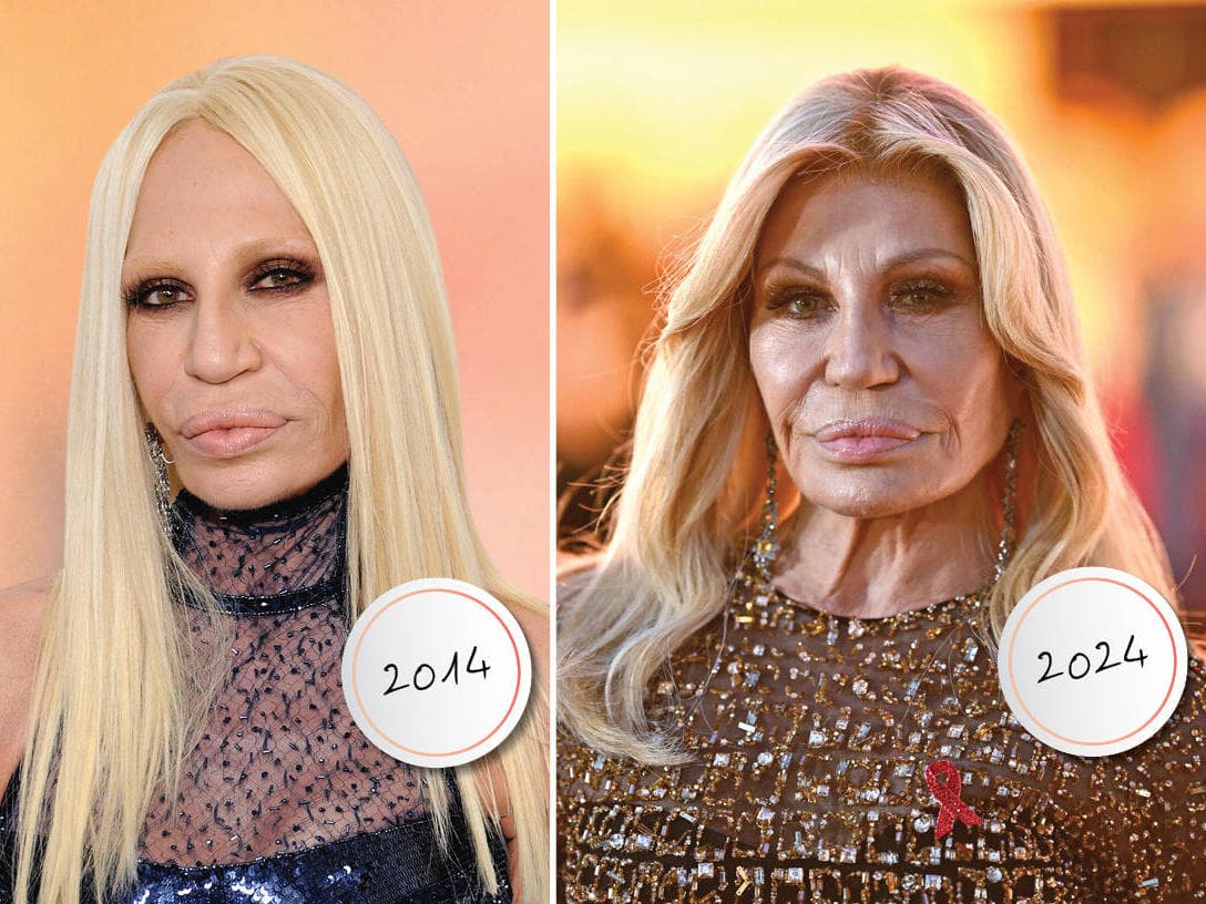 מי את ומה עשית לדונטלה ורסאצ'ה?