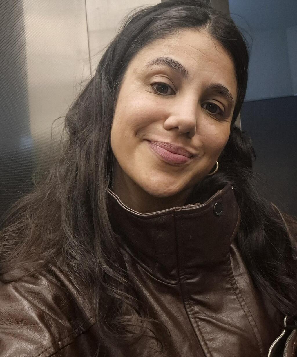 עדיין נפוח ומורם יותר ממה שיהיה בהמשך. לרוב לוקח לו כמעט שנה לתפוס את הצורה הסופית - אז דרושה לא מעט סבלנות. כאן שבועיים אחרי הניתוח (צילום: אלבום פרטי) אהובית רבי-גולן שבועיים אחרי הניתוח