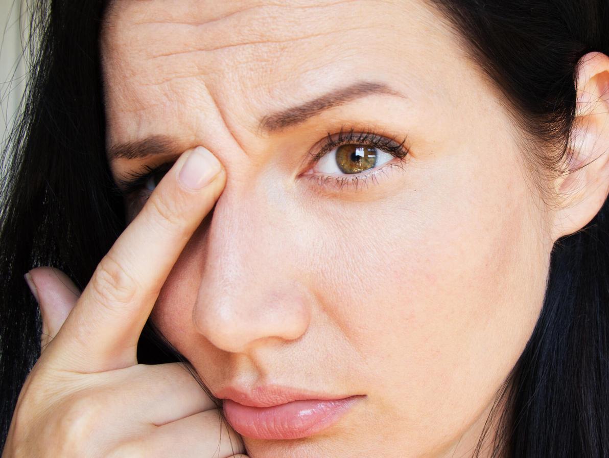 אשה עם קמטים במצח (צילום: Shutterstock/ASAP creative) אשה עם קמטים במצח