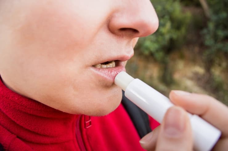 יובש בשפתיים בחורף: במיוחד בקרב אלה הנוטלים תוספי ויטמין A 