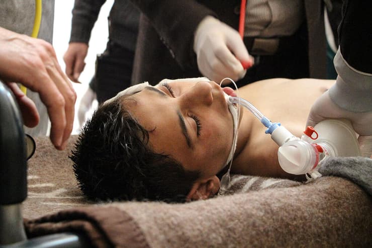 ילד סורי שנפגע במתקפה כימית של משטר אסד, ב-2017. סוריה לא באמת ויתרה על הנשק הזה