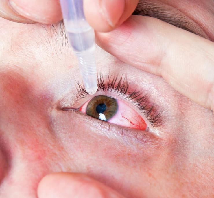 טיפות אנטיביוטיות לטיפול בנזק לעיניים