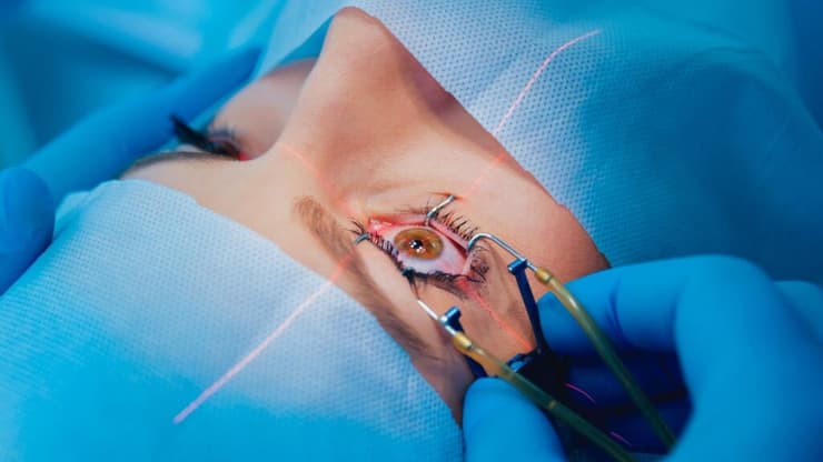 היפרדות רשתית ניתוח עיניים