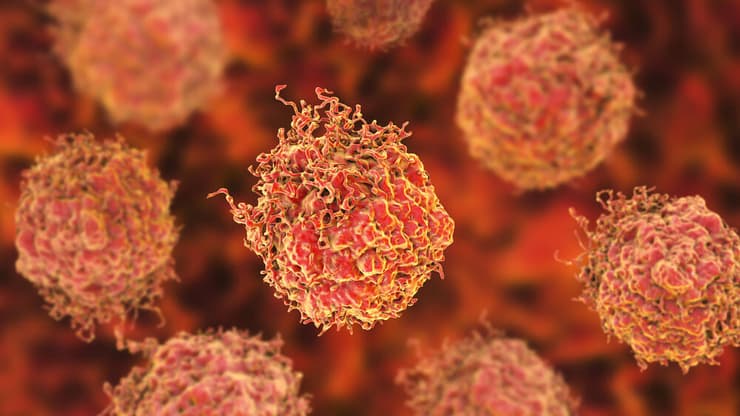  סרטן הערמונית