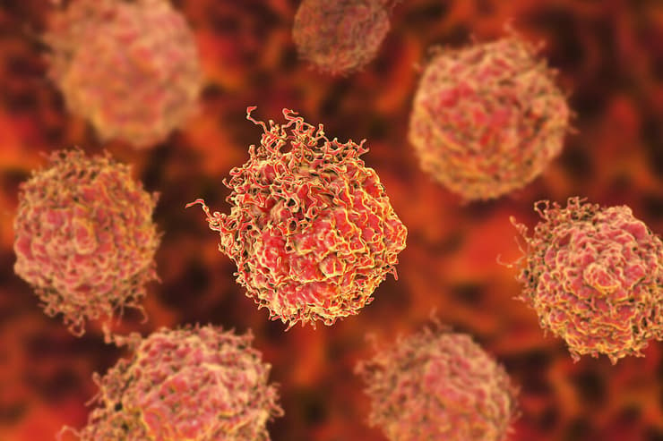 תאי הסרטן. ארגון האורולוגים הוציא לראשונה הנחיות לרופאים בנוגע לגילוי מוקדם של המחלה