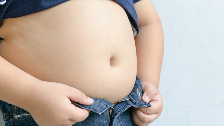 ילד שמן השמנה ילדים עודף משקל