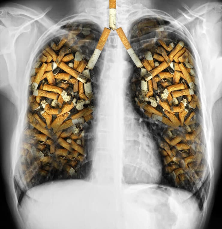 ריאות עם סיגריות