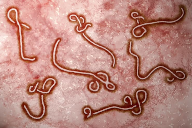 אבולה וירוס נגיף
