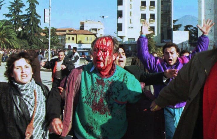 אזרח אלבני שנפצע במהומות