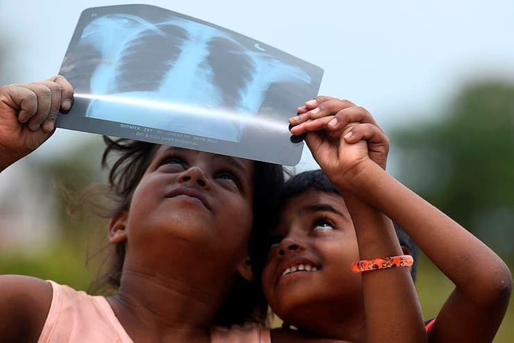 ילדים צופים בליקוי דרך צילום רנטגן בהודו