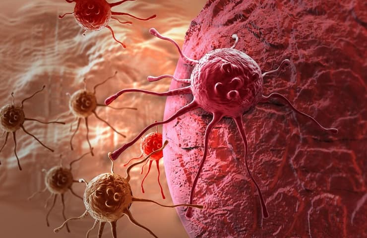 סרטן שד סרטן השד תאים סרטניים