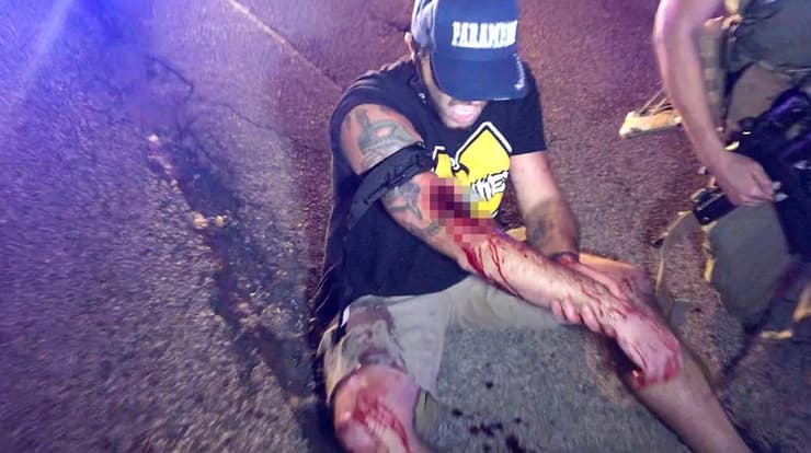 ארה"ב וויסקונסין מהומות אחרי ירי ב ג'ייקוב בלייק כאן רואים פצוע בתקרית ירי ב קנושה
