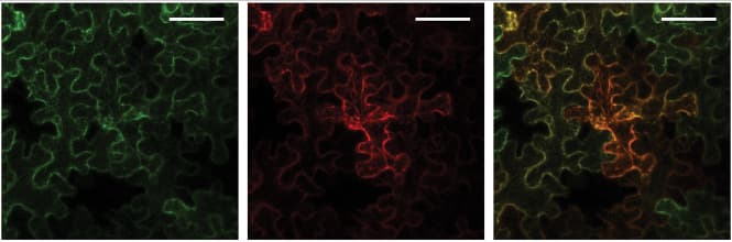 תא של Nicotiana benthamiana תחת מיקרוסקופ. משמאל: הרשתית התוך-פלזמית (מסומנת בירוק), במרכז: האנזים SOAP5 (מסומן באדום) ומימין – תמונה משולבת החושפת כי SOAP5 מצוי למרבה ההפתעה בתוך הרשתית התוך-פלזמית