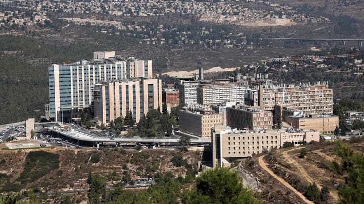 בית חולים הדסה עין כרם ירושלים
