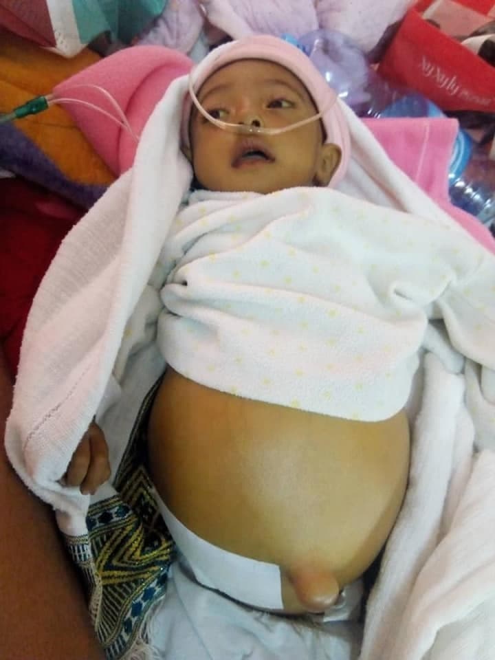 התינוקת במחנה הממתינים סובלת ממחלה קשה בכבד ומצויה בסכנת חיים