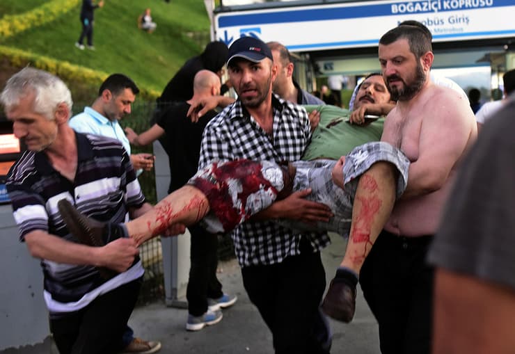 תמונת ארכיון יולי 2016 פצוע במהלך ניסיון הפיכה כושל איסטנבול טורקיה