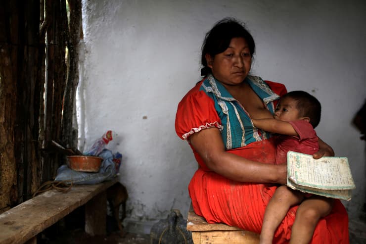 תינוק שאובחן כסובל מ ת-תזונה יונק ב עיירה לה פלמייה ב גואטמלה