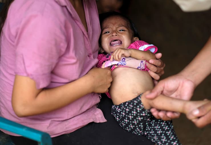 יסמין אניאילי תינוקת בת 22 חודשים שסובלת מרעב תת-תזונה בכפר לה סייבה ב גואטמלה