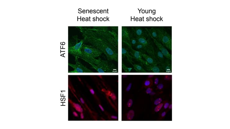 תמונת מיקרוסקופ - תאים זקנים (שמאל) וצעירים (ימין) שעברו הלם חום ונצבעו למיקומם התוך-תאי של שני פקטורי שיעתוק החשובים לתגובה התאית לסטרס, ATF6 (ירוק) ו-HSF1 (אדום). גרעינים נצבעו בכחול. בתמונה רואים שבעוד בתאים הצעירים נכנסים שני פקטורי השיעתוק לגרעין התא, כפי שאמור להתרחש על מנת להפעיל תגובת שיעתוק מיטבית לסטרס, בתאים זקנים שני הפקטורים לא מצליחים להיכנס לגרעין בצורה מלאה. בנוסף, HSF1 יוצר מבנה מיוחד אופטימלי לשיעתוק של נקודות בתאים הצעירים, אך לא בתאים הזקנים
