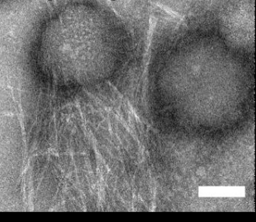 הפפטיד יופרין 3.5 מופרש על עור הקרפדה בתצורה "רדומה", בה מולקולות הפפטיד מתארגנות לכדי סיב עמילואידי מסוג cross-β. בעת חשיפה לחיידקים יש האצה של יצירת סיבים מסוג cross-α על גבי קרומי התא של אותם חיידקים שמובילים להרג. התמונות נלקחו באמצעות מיקרוסקופ אלקטרונים חודר (TEM) במרכז למיקרוסקופיית אלקטרונים בפקולטות להנדסת חומרים ולהנדסה כימית בטכניון. המבנה האטומי cross-α נקבע באמצעות מאיץ החלקיקים האירופי בצרפת (ESRF)