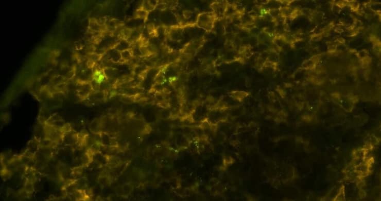 חיידקי סלמונלה (ירוק בוהק) הנמצאים בתוך מקרופאגים (צהוב-חום) של עכבר