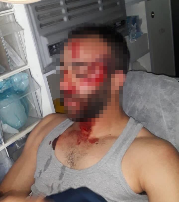 מהנד מחאג'נה נפצע קשה בהפגנה באום אל פחם