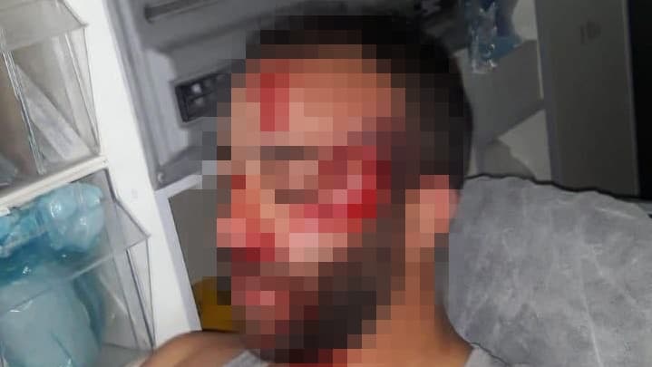 מהנד מחאג'נה נפצע קשה בהפגנה באום אל פחם