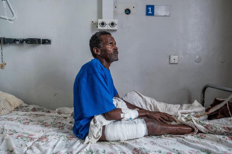 אתיופיה חשד ל פשעי מלחמה ב תיגראי כפר דנגולט טמרת קידאנו