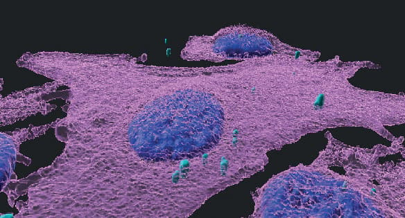 תמונת תלת-ממד של תאי מלנומה (בוורוד, גרעיני התאים - בכחול) הנגועים בחיידקים (מסומנים בטורקיז)