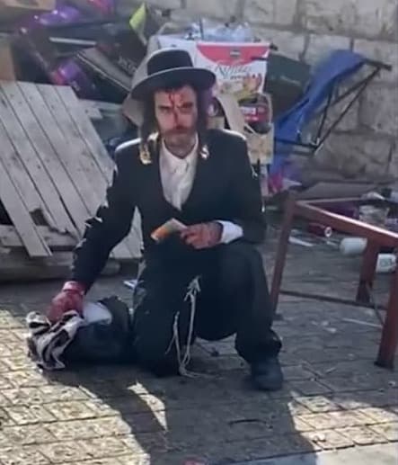 יהודי הותקף על ידי ערבים באזור שער שכם ונפצע בראשו 