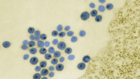 תמונת מיקרוססקופ של חלקיקי HIV