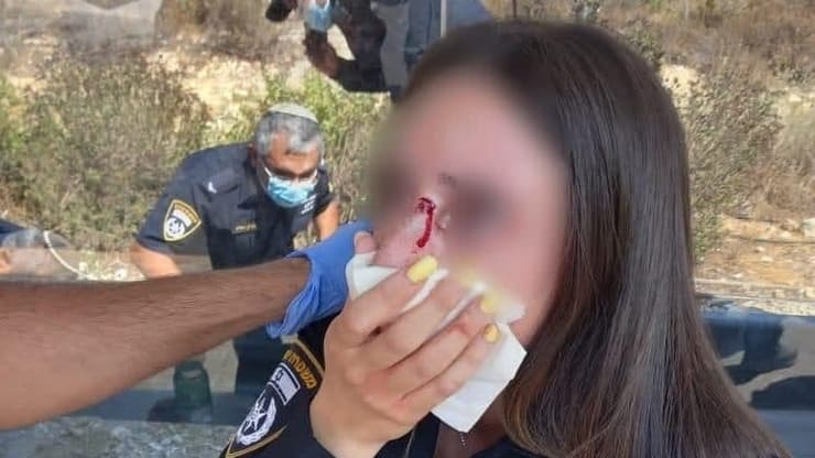 שוטרת הותקפה בפניה במהלך אכיפת עטיית מסיכה בתחבורה ציבורית סמוך לירושלים