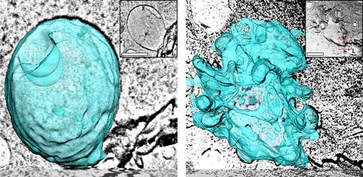 ספלאש: בועית גדולה לפני ואחרי הסחיטה (מסומנת בטורקיז). דימות תלת-ממד במיקרוסקופ אלקטרונים