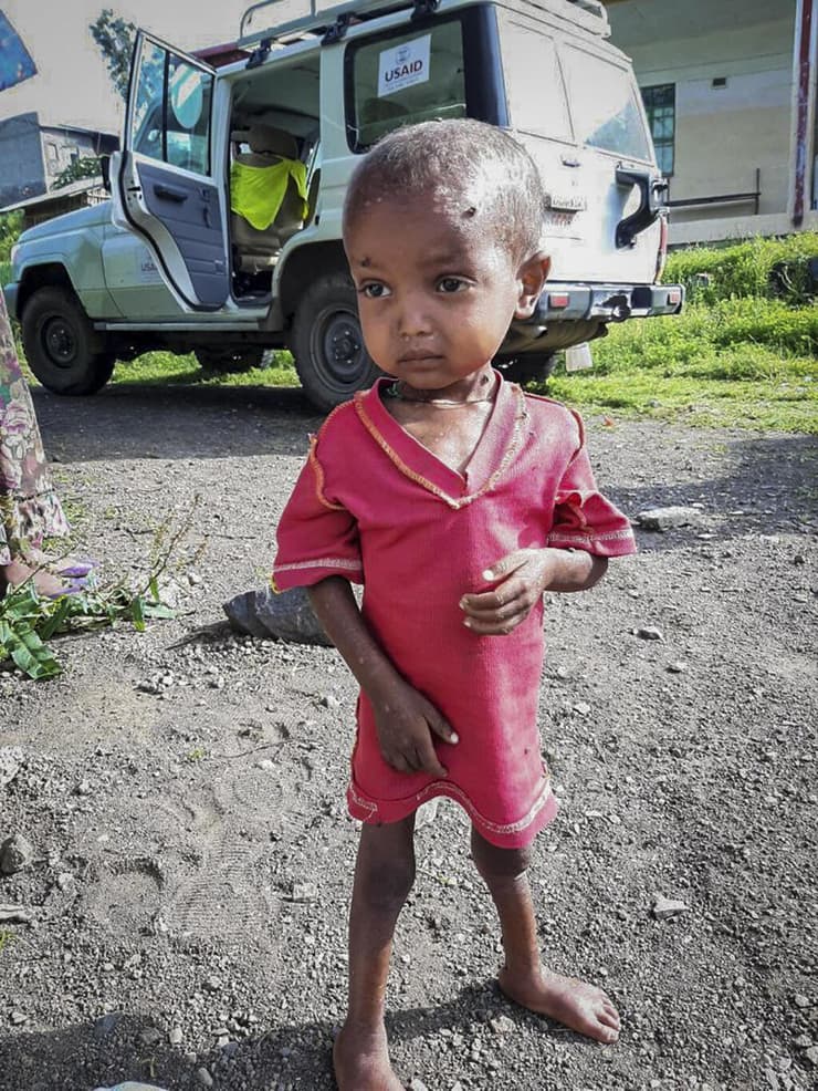 אתיופיה רעב תיגראי שוקלים ילד