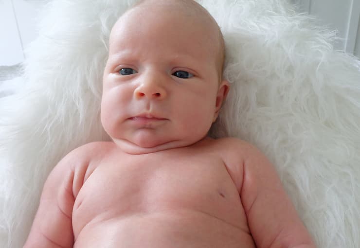 מחקר יוד תינוקות במשקל גבוה