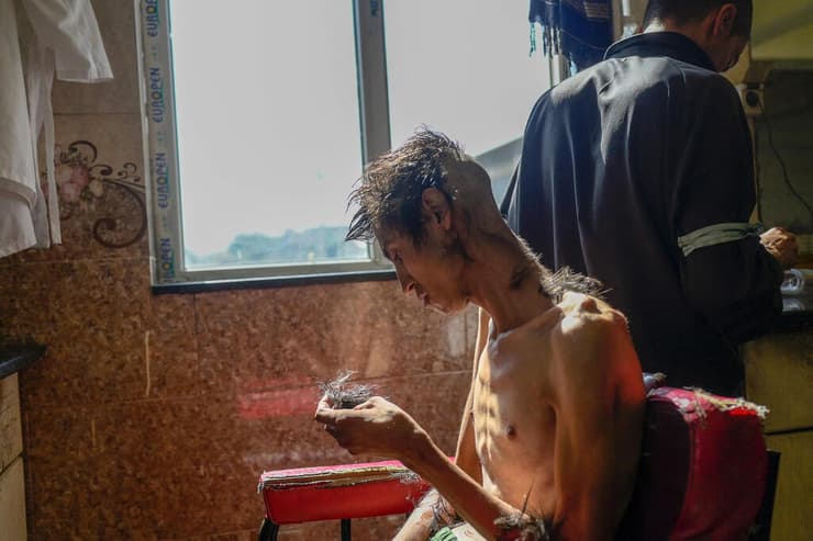 תמונות השנה של AFP שנת 2021 נגמל מסמים ראשו נגזז לפני תהליך ניקוי רעלים ב בית חולים קאבול אפגניסטן 16 אוקטובר
