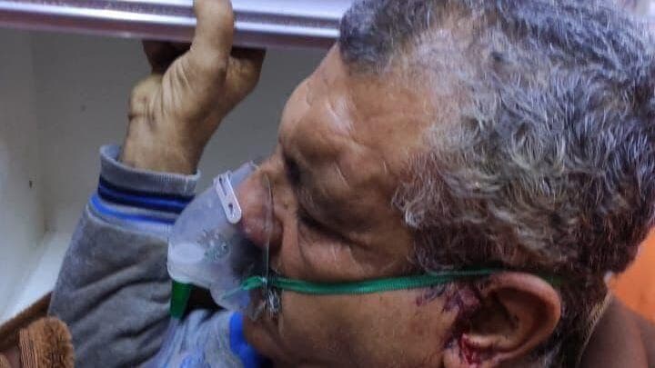 וואאל מוקבל מפונה לבית החולים לאחר התקיפה