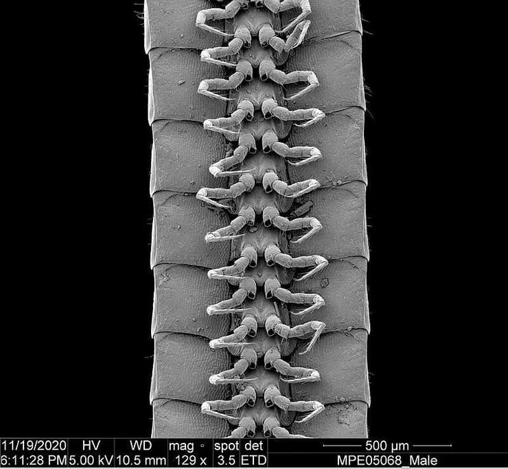 צילום מיקרוסקופי של הרגליים