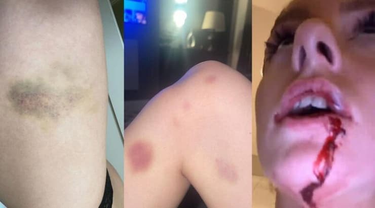 החבלות על הארייט רובסון