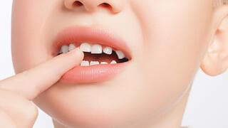 שן חלב שיני חלב שיניים שיניים נשירות שן נשירה יום פיית השיניים