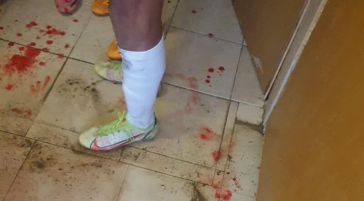 הדם בחדר ההלבשה