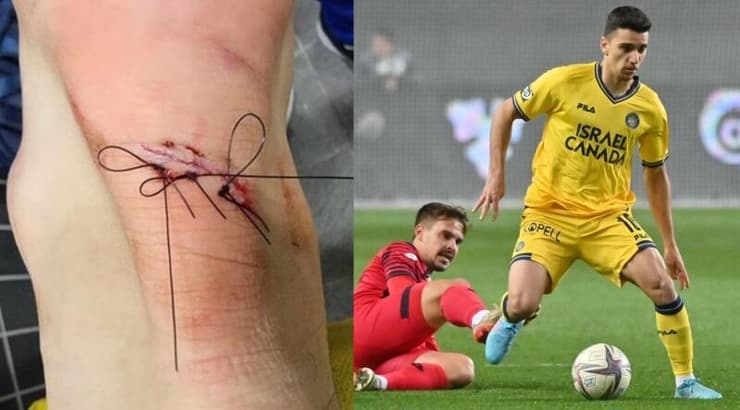 נראה כואב. דן ביטון והפציעה