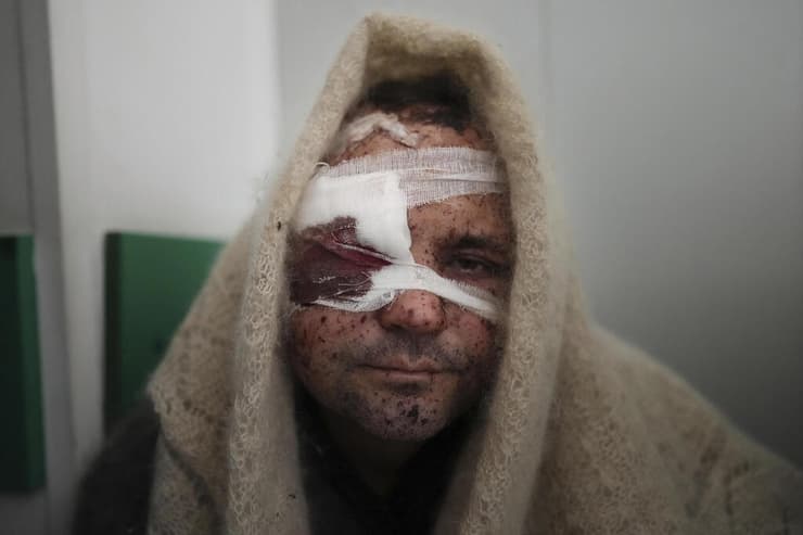 סרהי קראליה בן 41 ב בית חולים אחרי שנפצע ב הפגזה של רוסיה בעיר מריופול ב אוקראינה 11 במרץ